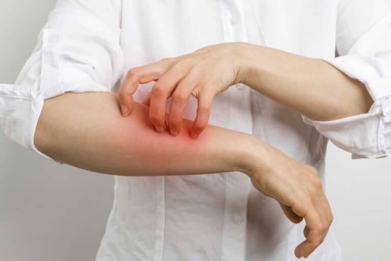 allergie au poivre 1