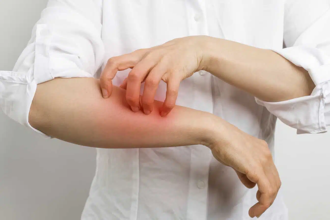 allergie au poivre 1