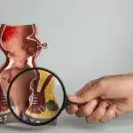 combien de temps dure une hemorroide externe 1