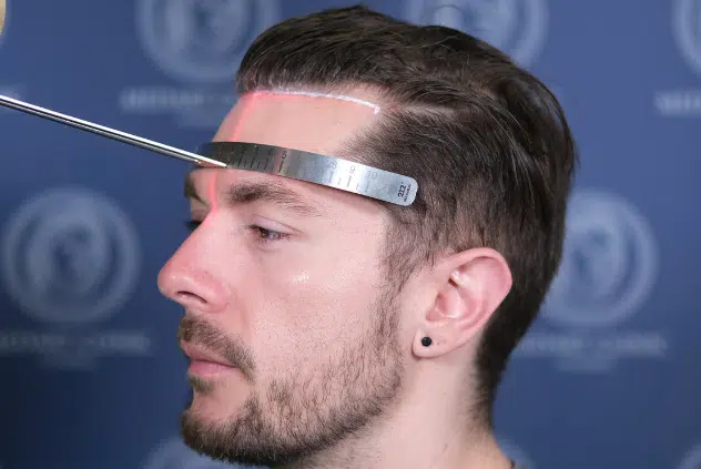 medart hair hairline design