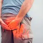 photo d un hemoroide 1