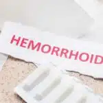 que faire pour les hemoroide 1