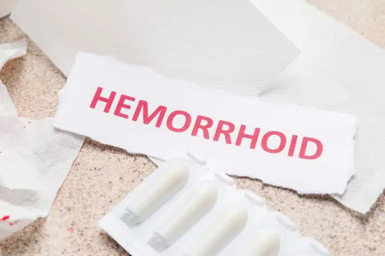 que faire pour les hemoroide 1