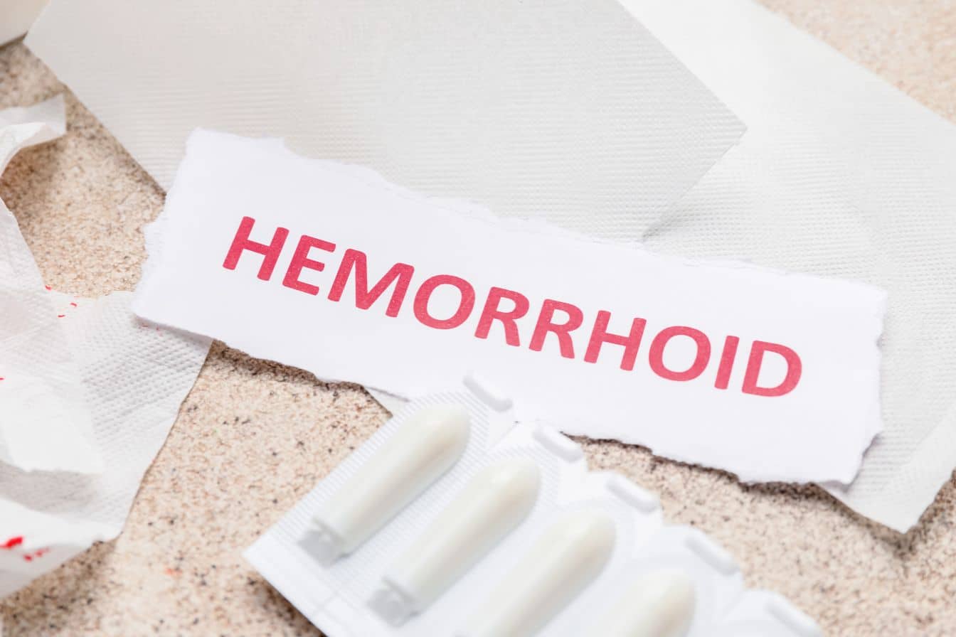 que faire pour les hemoroide 1