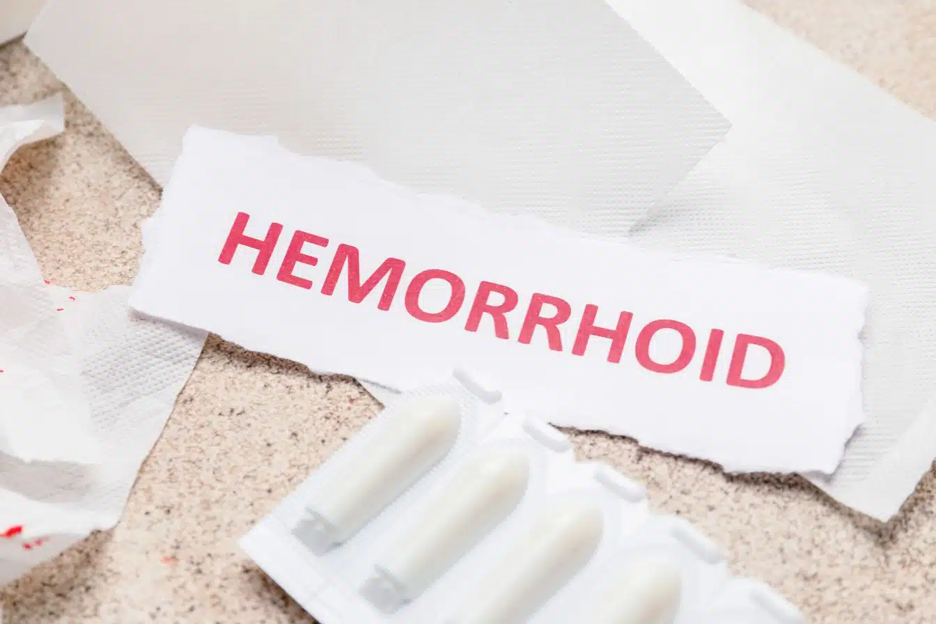 que faire pour les hemoroide 1